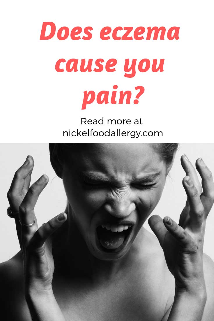 Does eczema cause you pain? Nickel Food Allergy